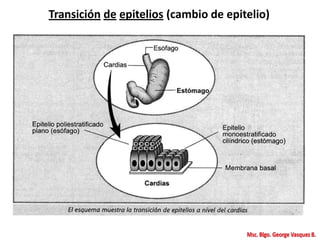 Transición de epitelios (cambio de epitelio)
 