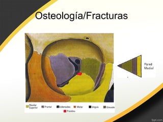 Osteología/Fracturas
 
