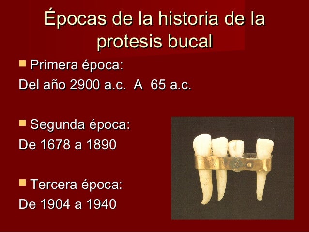 1.1 antecedentes históricos de la prótesis bucal 2009