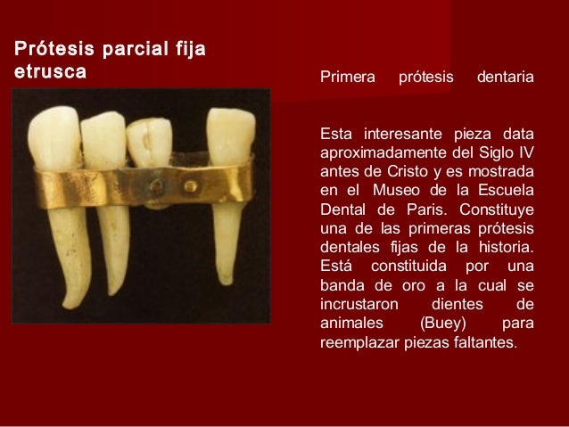 1.1 antecedentes históricos de la prótesis bucal 2009
