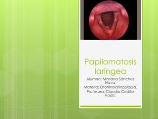 Papilomatosis
laríngea
Alumna: Mariana Sánchez
Nava.
Materia: Otorrinolaringología.
Profesora: Claudia Cedillo
Rojas.
 