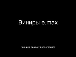 Виниры e.max

Клиника Дантист представляет

 