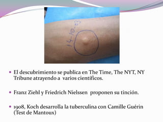  El descubrimiento se publica en The Time, The NYT, NY

Tribune atrayendo a varios científicos.
 Franz Ziehl y Friedrich Nielssen proponen su tinción.
 1908, Koch desarrolla la tuberculina con Camille Guérin

(Test de Mantoux)

 
