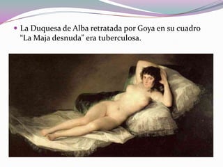  La Duquesa de Alba retratada por Goya en su cuadro

“La Maja desnuda” era tuberculosa.

 