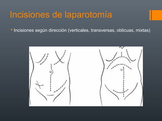 1 Incisiones De Laparotomia PPT 1-incisiones-de-laparotomia-ppt