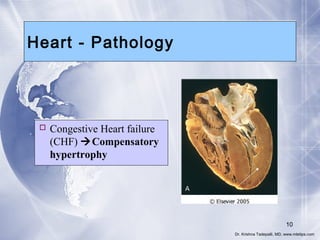 1. heart pathology; heart failure | PPT