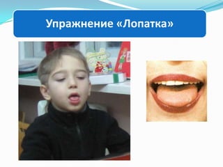 Упражнение «Лопатка»

 