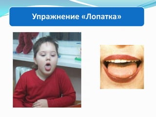 Упражнение «Лопатка»

 