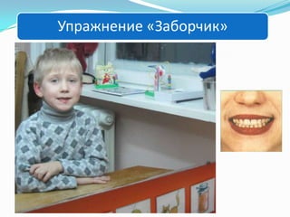 Упражнение «Заборчик»

 