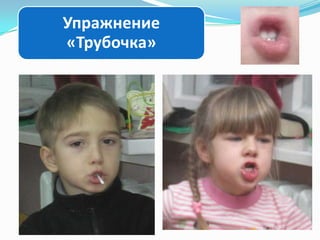 Упражнение
«Трубочка»

 