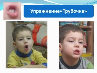 Упражнение«Трубочка»

 