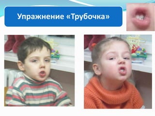 Упражнение «Трубочка»

 