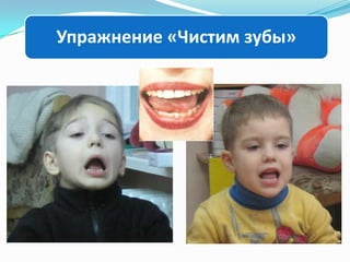 Упражнение «Чистим зубы»

 