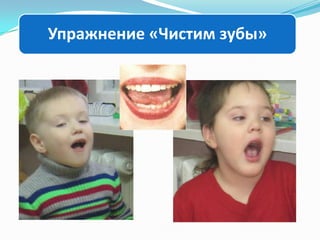 Упражнение «Чистим зубы»

 