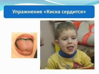 Упражнение «Киска сердится»

 