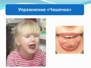 Упражнение «Чашечка»

 