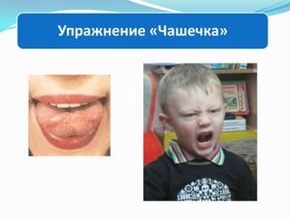 Упражнение «Чашечка»

 