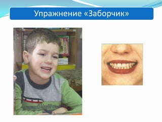 Упражнение «Заборчик»

 