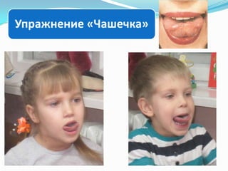 Упражнение «Чашечка»

 