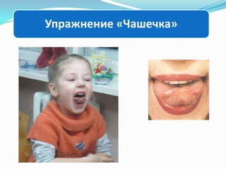 Упражнение «Чашечка»

 