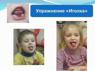 Упражнение «Иголка»

 