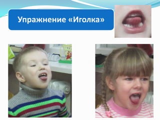 Упражнение «Иголка»

 