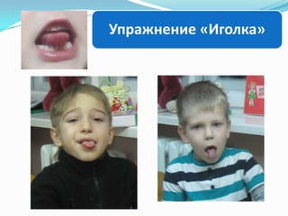 Упражнение «Иголка»

 