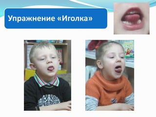 Упражнение «Иголка»

 