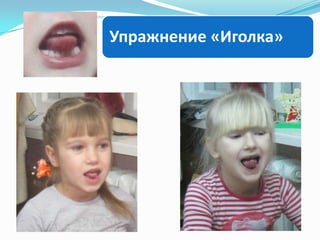 Упражнение «Иголка»

 