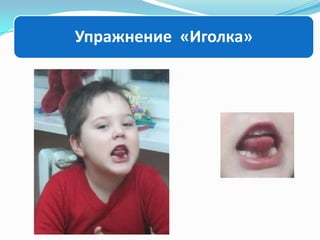 Упражнение «Иголка»

 