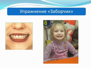 Упражнение «Заборчик»

 