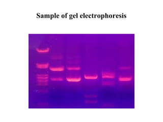 Sample of gel electrophoresis

 