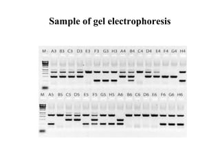 Sample of gel electrophoresis

 