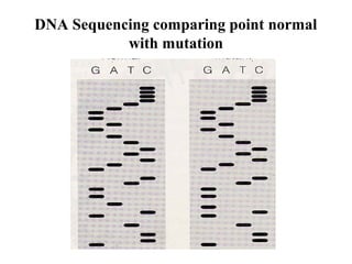 DNA Sequencing comparing point normal
with mutation

 