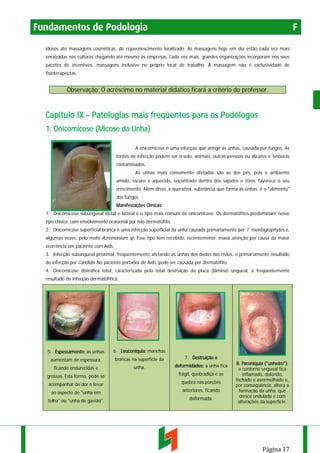 Fundamentos de Podologia

F

idosos até massagens cosméticas, de rejuvenescimento localizado. As massagens hoje em dia estão cada vez mais
enraizadas nas culturas chegando até mesmo às empresas. Cada vez mais, grandes organizações incorporam nos seus
pacotes de incentivos, massagens inclusive no próprio local de trabalho. A massagem não é exclusividade de
fisioterapeutas.

Observação: O acréscimo no material didático ficará a critério do professor.

Capítulo IX – Patologias mais freqüentes para os Podólogos
1. Onicomicose (Micose da Unha)
A onicomicose é uma infecção que atinge as unhas, causada por fungos. As
fontes de infecção podem ser o solo, animais, outras pessoas ou alicates e tesouras
contaminados.
As unhas mais comumente afetadas são as dos pés, pois o ambiente
úmido, escuro e aquecido, encontrado dentro dos sapatos e tênis, favorece o seu
crescimento. Além disso, a queratina, substância que forma as unhas, é o "alimento"
dos fungos.
Manifestações Clínicas:
1. Onicomicose subungueal distal e lateral é o tipo mais comum de onicomicose. Os dermatófitos predominam nesse
tipo clínico, com envolvimento ocasional por não dermatófito.
2. Onicomicose superficial branca é uma infecção superficial da unha causada primariamente por T. mentagrophytes e,
algumas vezes, pelo mofo Acremonium sp. Esse tipo tem recebido, recentemente, maior atenção por causa da maior
ocorrência em paciente com Aids.
3. Infecção subungueal proximal, freqüentemente afetando as unhas dos dedos das mãos, é primariamente resultado
de infecção por Candida. No paciente portador de Aids, pode ser causada por dermatófito.
4. Onicomicose distrófica total, caracterizada pela total destruição da placa (lâmina) ungueal, é freqüentemente
resultado de infecção dermatofítica.

5. Espessamento: as unhas

6. Leuconíquia: manchas

aumentam de espessura,

brancas na superfície da

7. Destruição e

ficando endurecidas e

unha.

deformidades: a unha fica

grossas. Esta forma, pode se

frágil, quebradiça e se

acompanhar de dor e levar

quebra nas porções

ao aspecto de "unha em

anteriores, ficando

telha" ou "unha de gavião".

deformada.

8. Paroníquia ("unheiro"):
o contorno ungueal fica
inflamado, dolorido,
inchado e avermelhado e,
por conseqüência, altera a
formação da unha, que
cresce ondulada e com
alterações da superfície.

Página 17

 