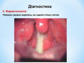 Діагностика
3. Фарингоскопія
•Наявна смужка виділень на задній стінці глотки

 