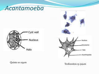 Acantamoeba

Quiste 10-25 m

Trofozoítos 15-50 m

 
