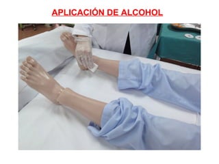 APLICACIÓN DE ALCOHOL

 