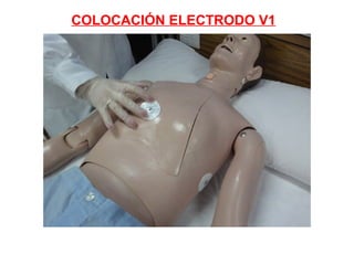 COLOCACIÓN ELECTRODO V1

 