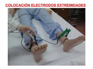 COLOCACIÓN ELECTRODOS EXTREMIDADES

 