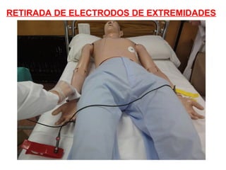 RETIRADA DE ELECTRODOS DE EXTREMIDADES

 