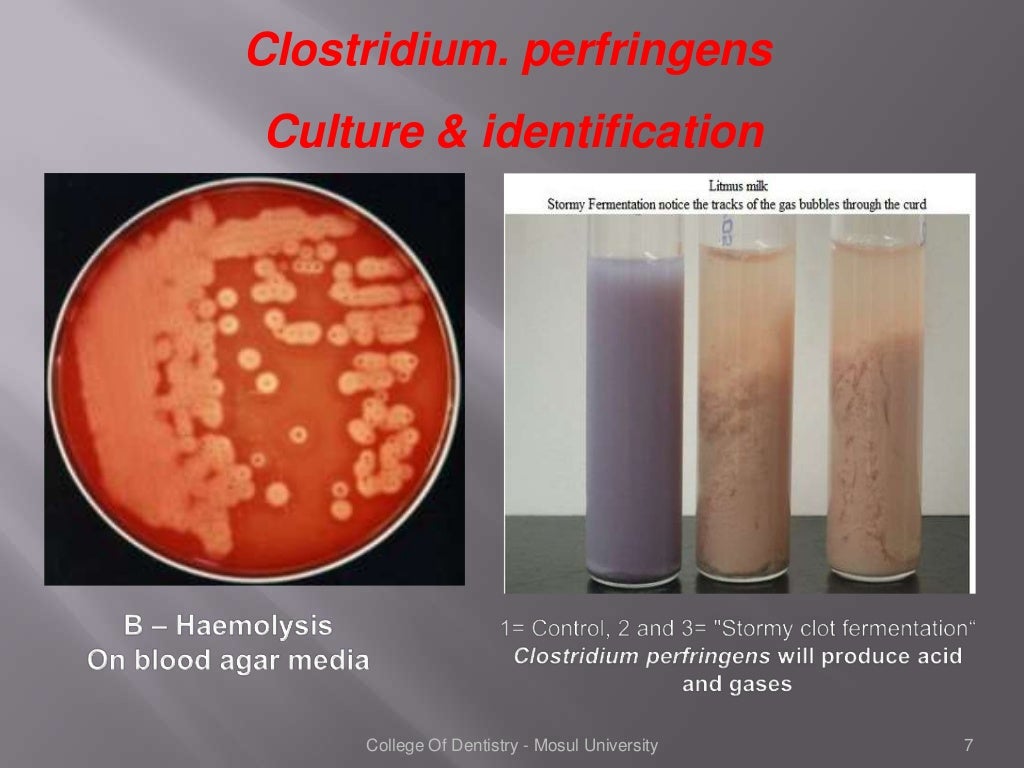 Clostridium species Microbiology