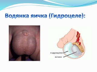 Порядок проведения RUC1 - Способ обрезания крайней плоти - Google Patents