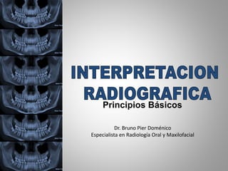 Principios Básicos
Dr. Bruno Pier Doménico
Especialista en Radiología Oral y Maxilofacial
 