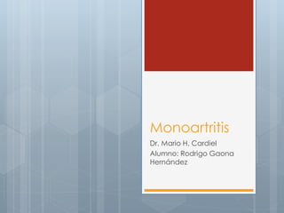 Monoartritis
Dr. Mario H. Cardiel
Alumno: Rodrigo Gaona
Hernández
 