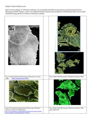 Student- Paola Caballero León
Below are four images of Tillandsia trichomes, two using Dark Field Microscopy and two using Scanning Electron
Microscopy (SEM). Figures 1 and 3 were obtained from the internet and correspond to SEM because there were no Dark
Field Microscopy photos of Tillandsia trichomes available.
Fig. 1 Scanning Electron Microscope Tillandsia usneoides
×400 http://journal.bsi.org/V29/2/
Fig. 2 Dark Field Microscope Tillandsia trichomes 100x
Fig.3 Colorized Scanning Electron Microscopy Tillandsia
trichomes unknown amplification.
http://www.gettyimages.com/detail/photo/colourised-sem-image-of-peltate-
hairs-of-a-high-res-stock-photography/135623209
Fig. 4 Dark Field Microscope Tillandsia trichomes 100x
green light filter
 