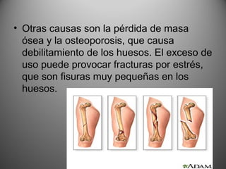 • Otras causas son la pérdida de masa
ósea y la osteoporosis, que causa
debilitamiento de los huesos. El exceso de
uso puede provocar fracturas por estrés,
que son fisuras muy pequeñas en los
huesos.
 