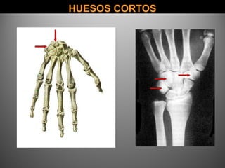HUESOS CORTOSHUESOS CORTOS
 