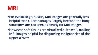 1. allergic rhinitis | PPTX