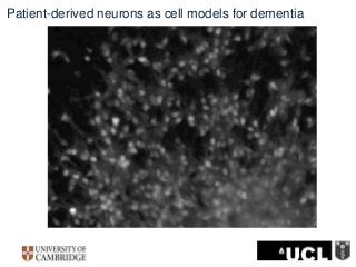 Patient-derived neurons as cell models for dementia
 